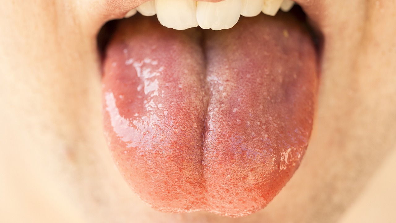 Farmakoterapia w chorobach błony śluzowej jamy ustnej