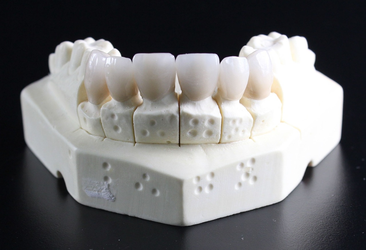  Wkłady i nakłady stomatologiczne - odbudowa zębów